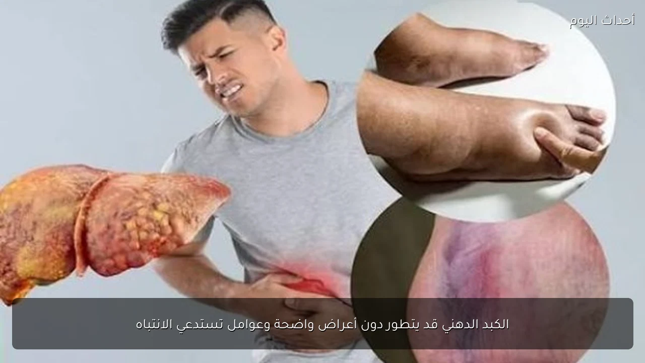 الكبد الدهني قد يتطور دون أعراض واضحة وعوامل تستدعي الانتباه