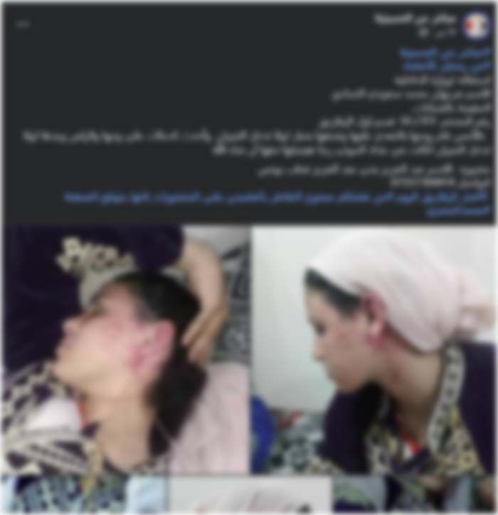 صورة من الحادثة