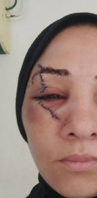 حادثة اعتداء في المحلة الكبرى