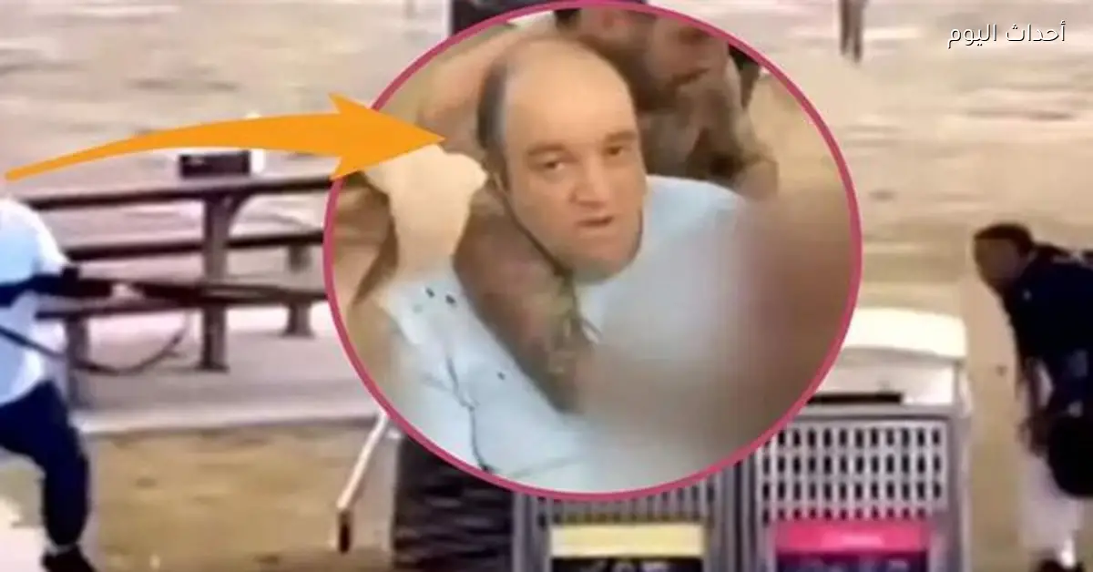 حملة تبرع لأحمد الأحمد تصل إلى مليون دولار وصورة جديدة له في مستشفى سيدني