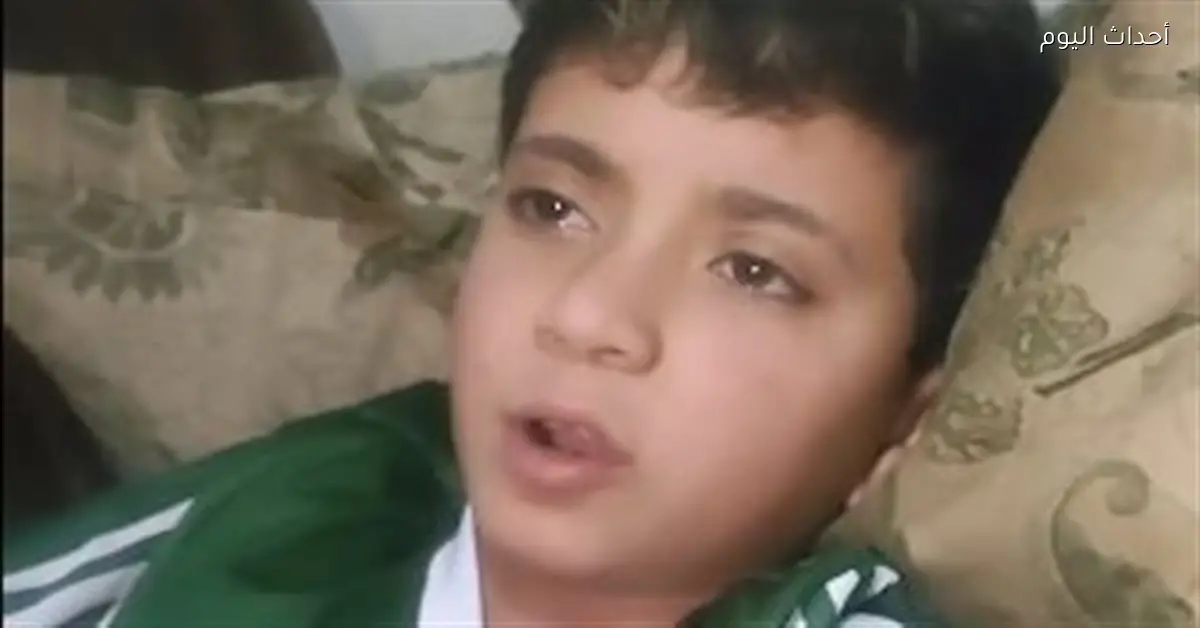 طفل يروي تفاصيل هجوم كلب ضال على ذراعه