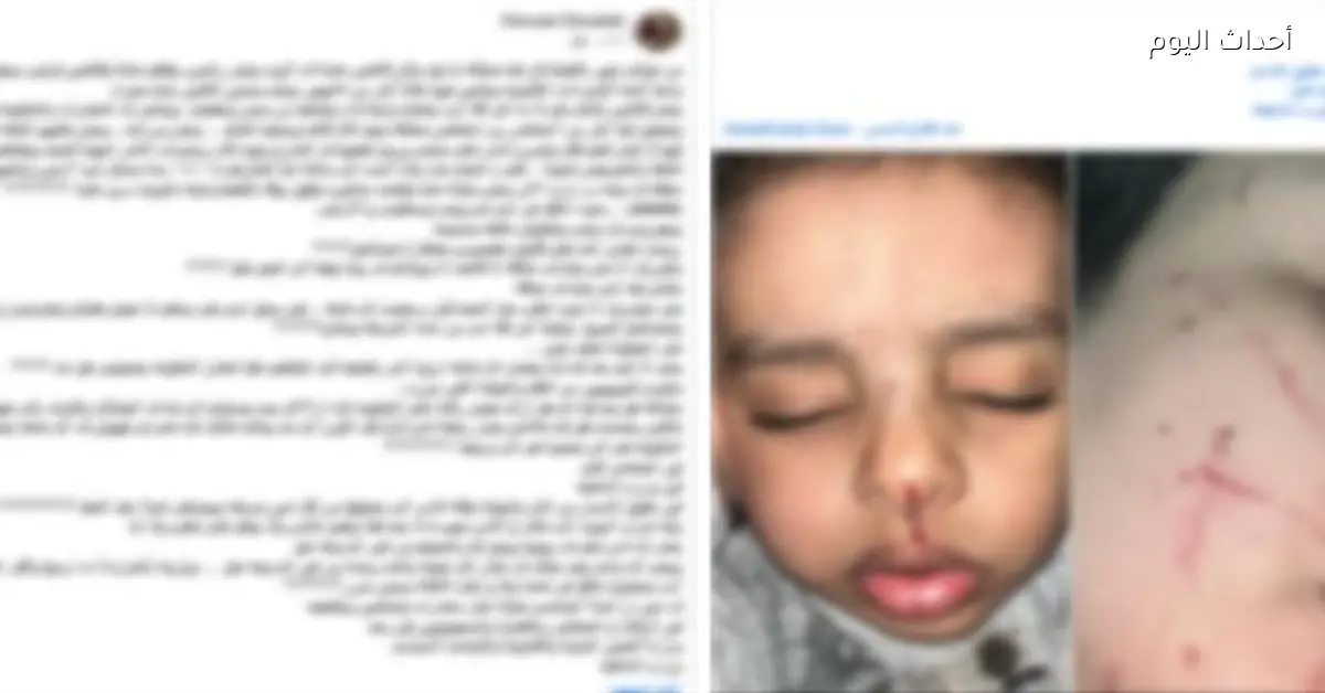 سيدة في الشرقية تتصالح مع جيرانها بعد اعتداء وإصابة نجلها
