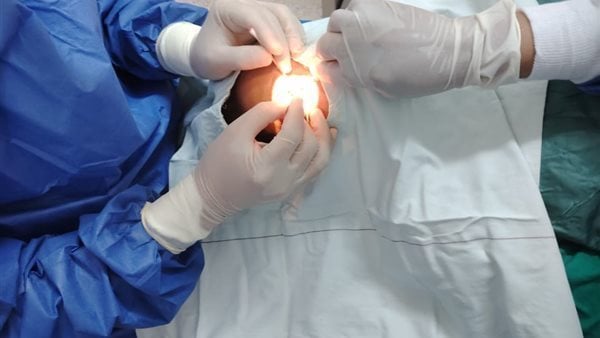 إحالة قضية العمى الجماعي بمستشفى 6 أكتوبر إلى لجنة الخبراء وتحديد جلسة للاطلاع في 24 يونيو