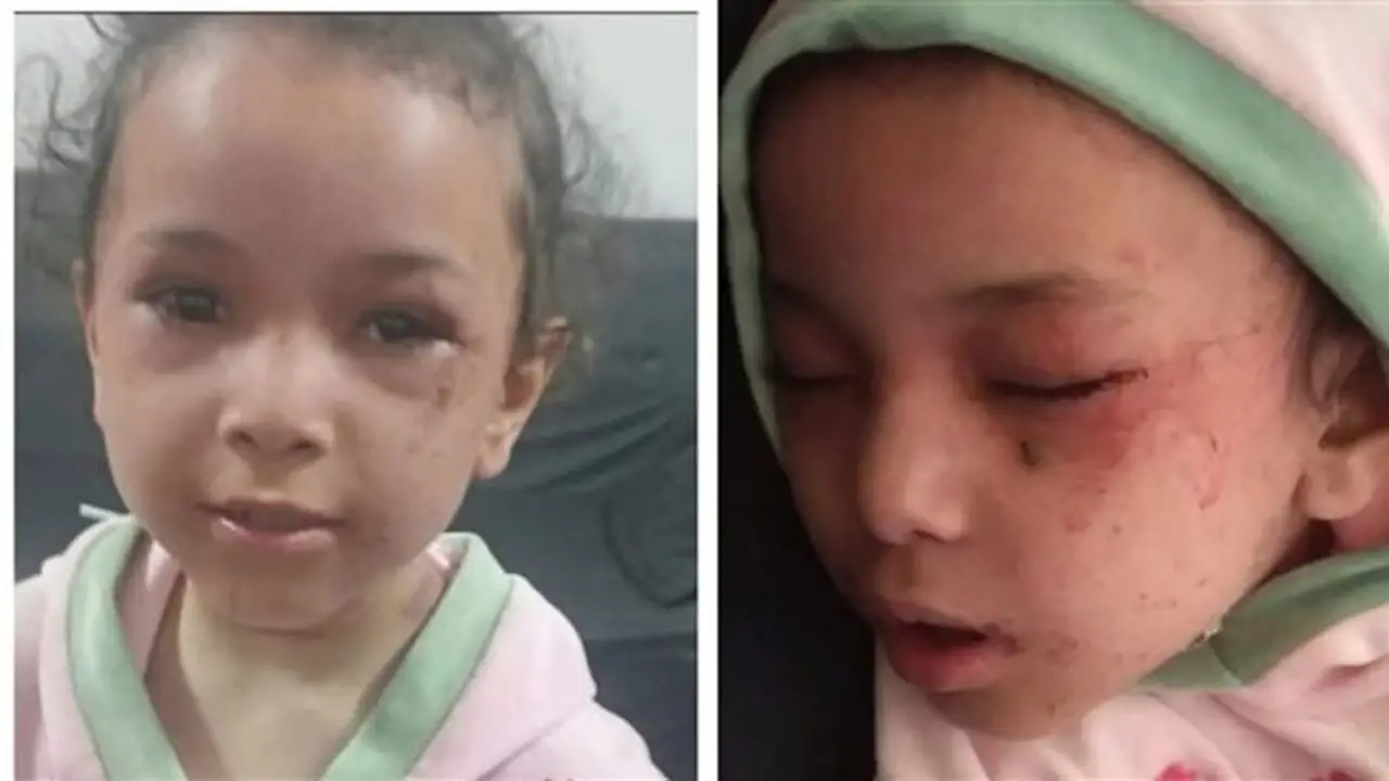 حكاية الطفلة بسملة: قصة عودتها من الموت على يد جارتها بالمنيا