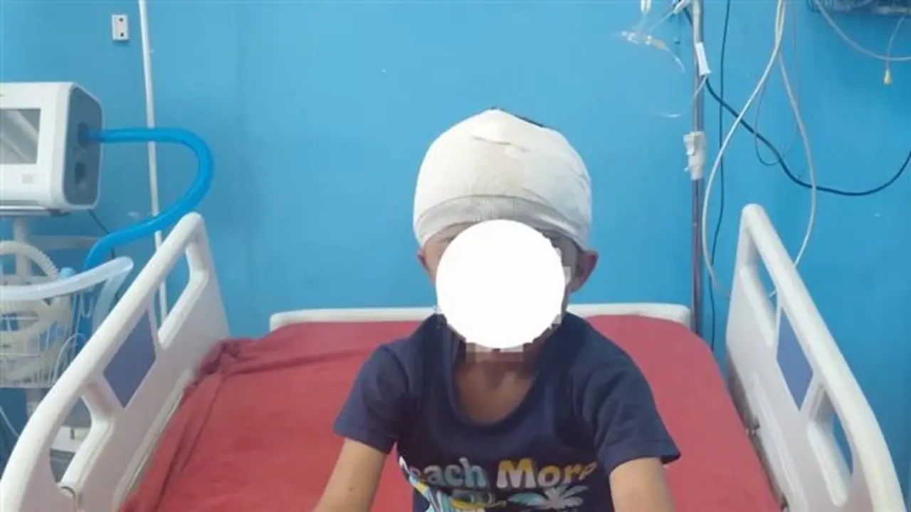 إنجاز طبي في سوهاج: استخراج رصاصة من مخ طفل وإنقاذه دون مضاعفات