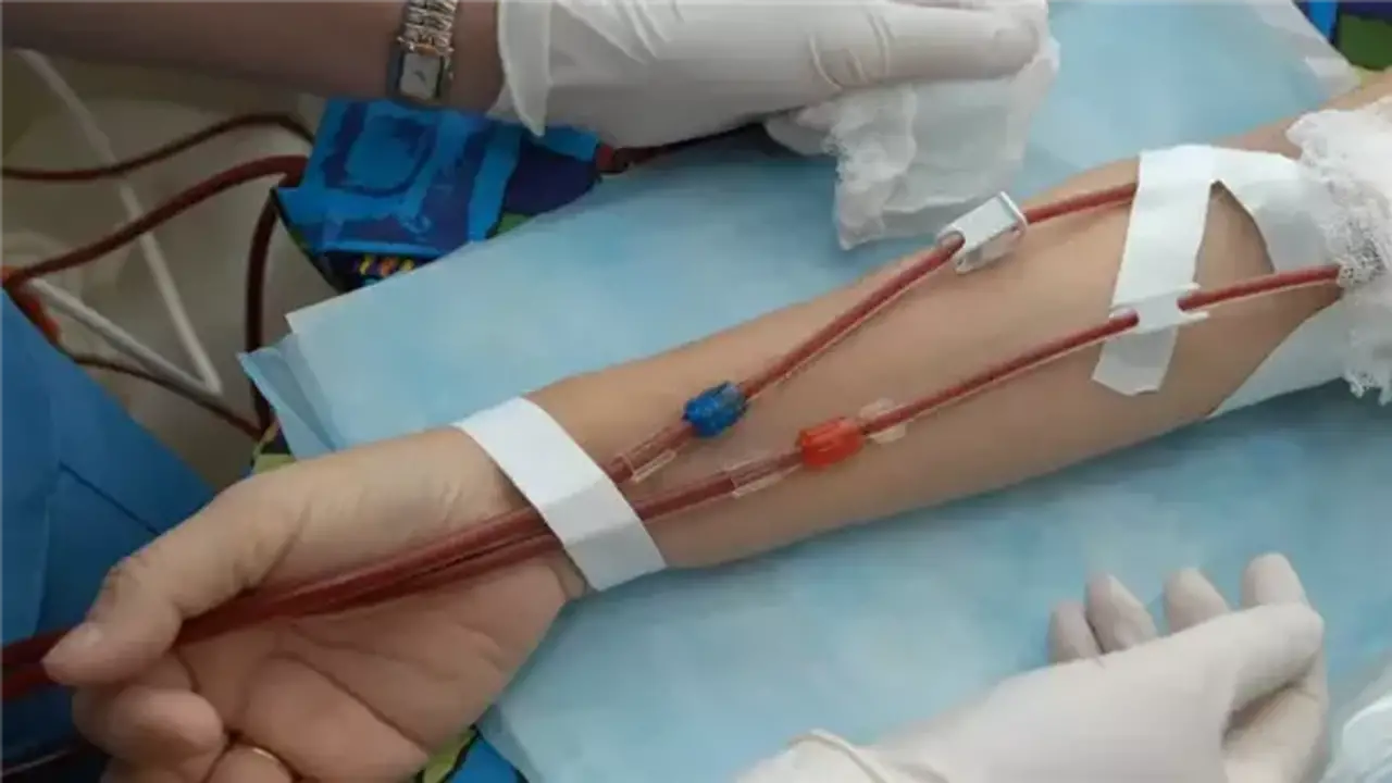 أسباب آلام العظام وطرق التعامل معها لدى مرضى الغسيل الكلوي